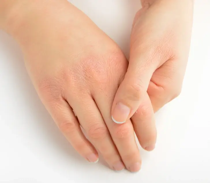 betegségek, depresszió, egészség, jelek, nyugtalan láb szindróma, Parkinson-kór, test, tünetek, vashiány, vérszegénység